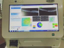 Visionix Optovue iScan 80 Automated OCT System